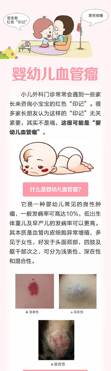 儿童医院血管瘤专家解析与诊疗指南