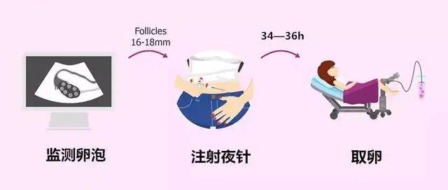 做试管取卵前需要服用的药物指南