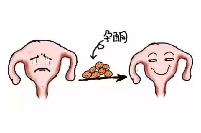 取卵后黄体酮的应用，塞药方法与注意事项