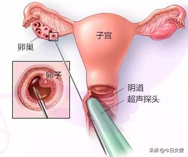 卵巢功能优越与取卵数量的探讨